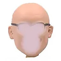 H1-Bald
